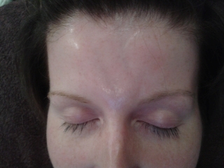 before picture